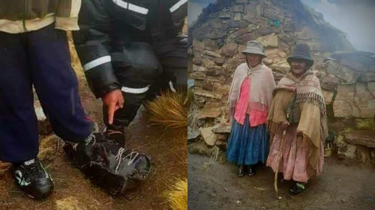 Huancané: Niño con pie grande pide apoyo para su tratamiento