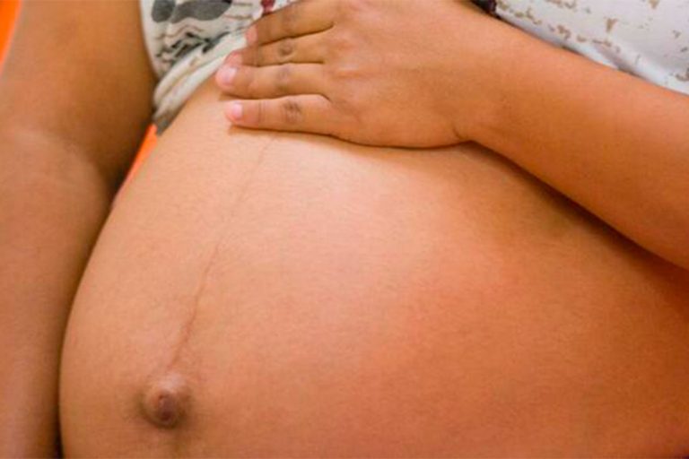 Aprueban mezclar dosis de Astrazeneca y Pfizer para embarazadas en Río de Janeiro
