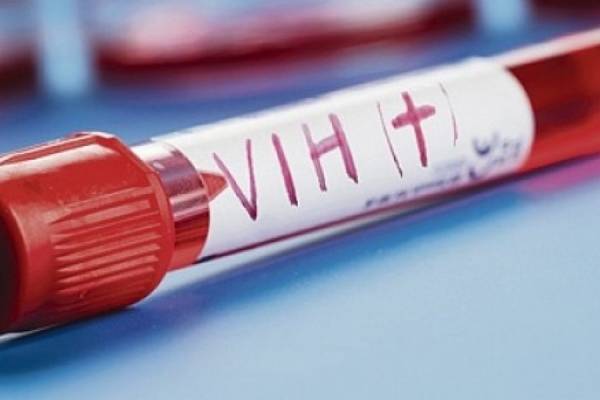 Advierten incremento de casos de VIH en adolescentes
