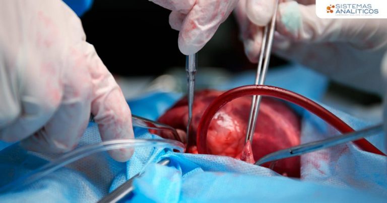 Aprueban ley donde todas las personas aceptan ser donantes de órganos tras su muerte