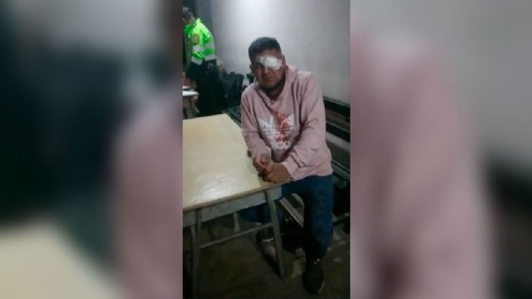 Hombre perdió la visión de un ojo durante una intervención policial