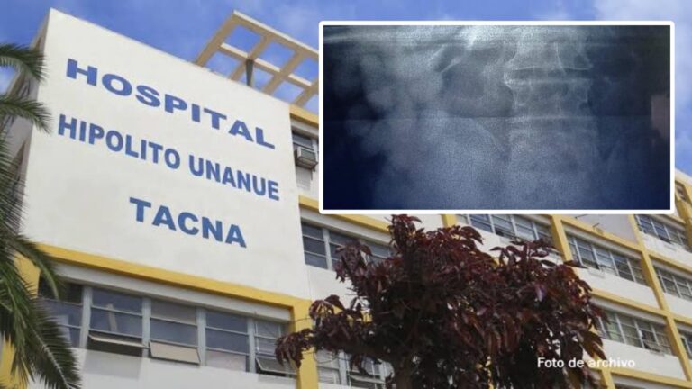 Varón ingresó al hospital Hipólito Unanue con más de 100 ovoides de droga en Tacna