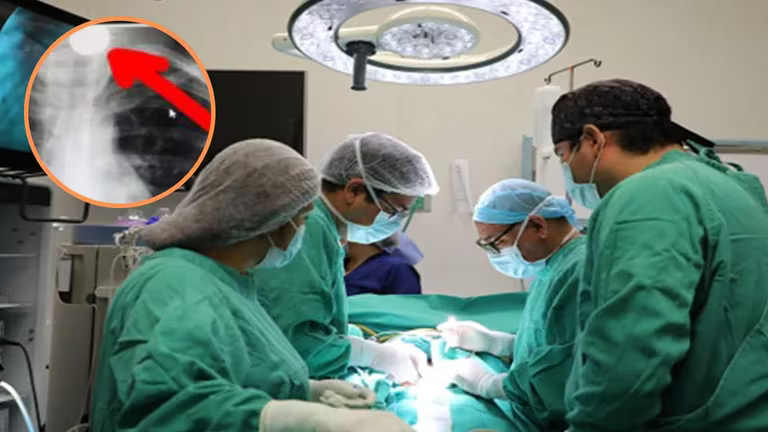 La Libertad: Médicos del Hospital II Chocope salvan a menor atorado con moneda de 10 céntimos