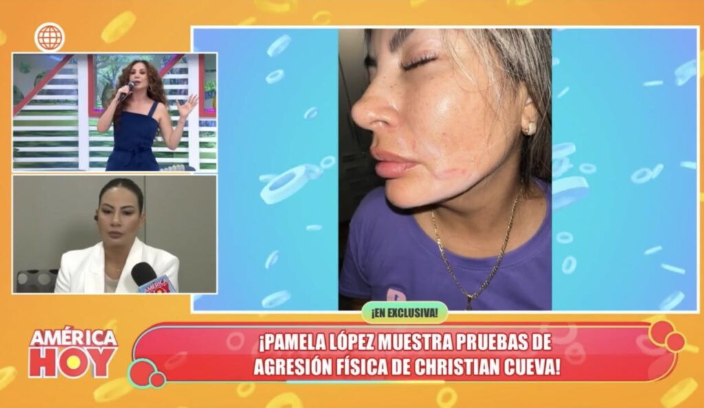 Pamela López denuncia a Christian Cueva por violencia física y psicológica, revelando pruebas y el impacto de sus agresiones.