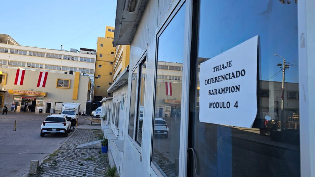sarampión