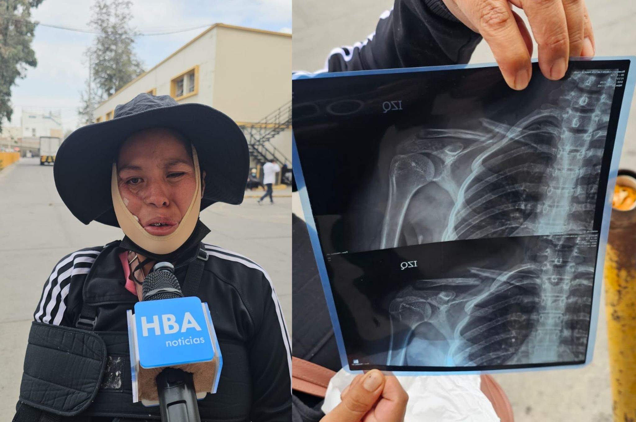 hba